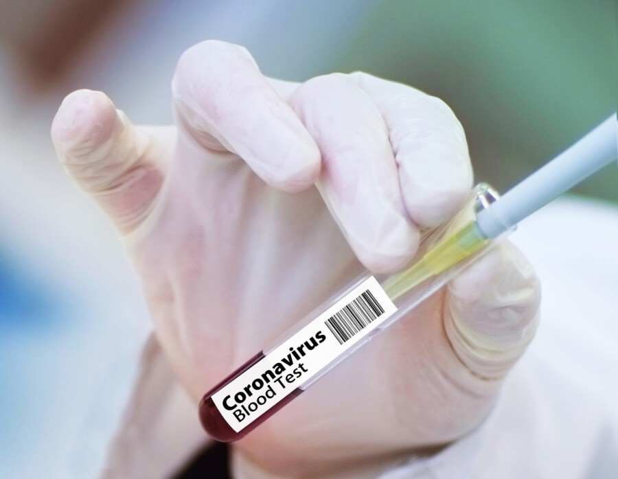 Die Firma Medicare bietet ab morgen (8. Februar) auch PCR-Tests im COVID-19-Testzentrum auf der Ankunftsebenedes Dortmunder Flughafens an. (Symbolfoto: Pixabay)
